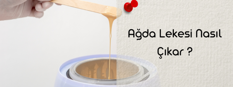 Ağda lekesi nasıl çıkar? Çözüm yolları